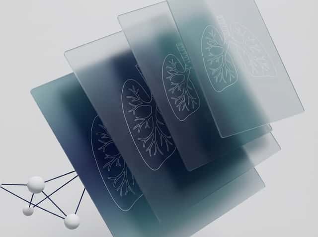 Qureight cover